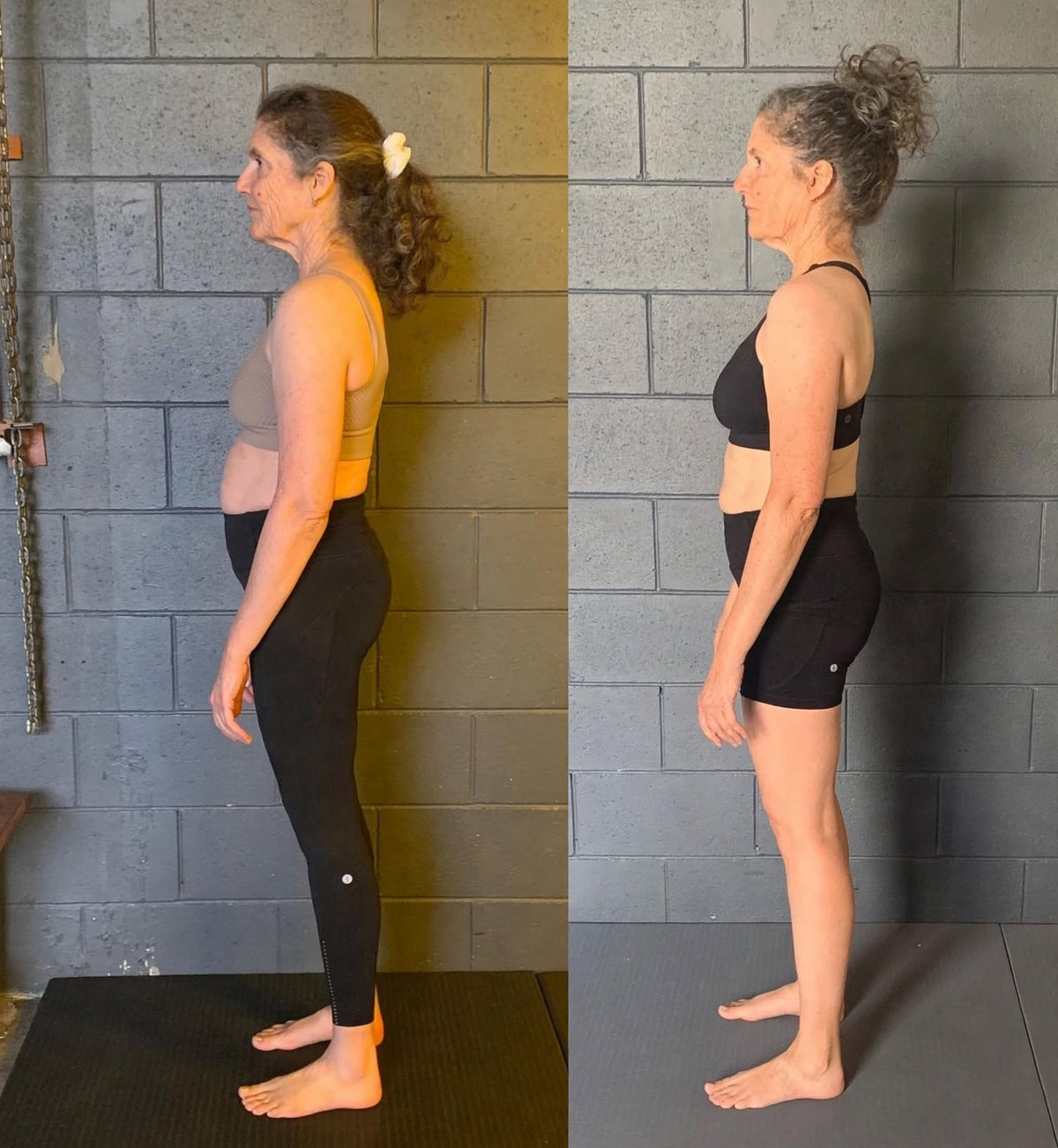 Stop Letting Years of Slouching Become Your “Normal.”